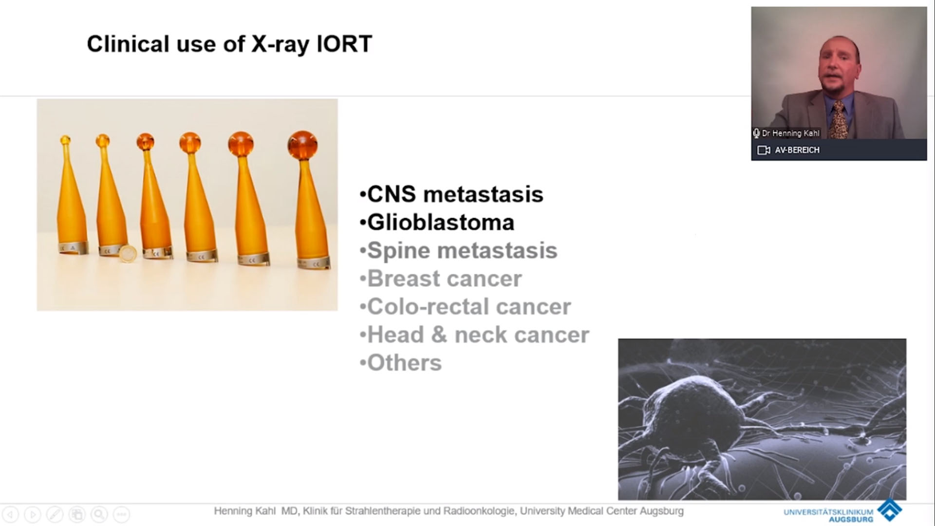 Intraoperative Radiotherapy For CNS Tumors