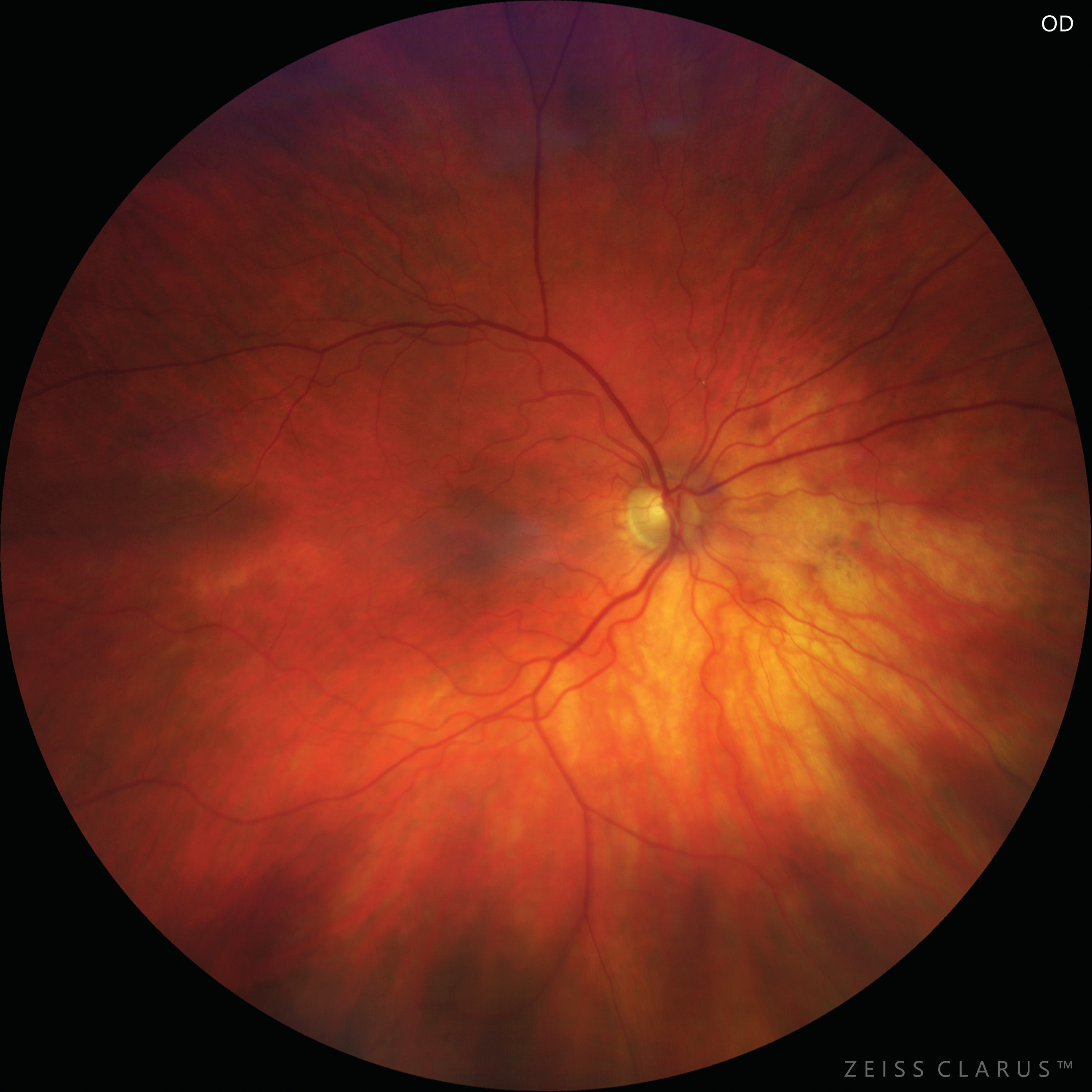 figure-031-6082-carotid-ultrasonography-a-b-mode-longitudinal-image