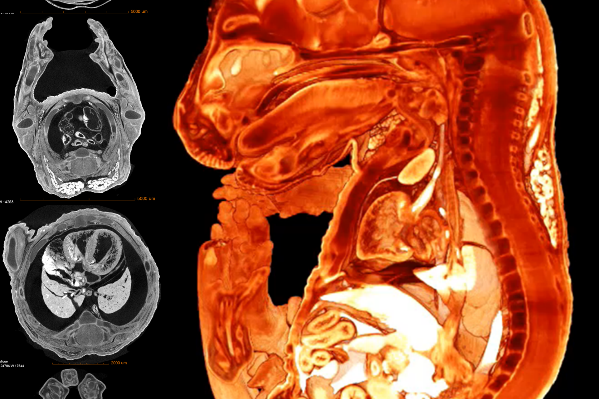 Mouse embryo imaged with Xradia Versa XRM to show internal structures.