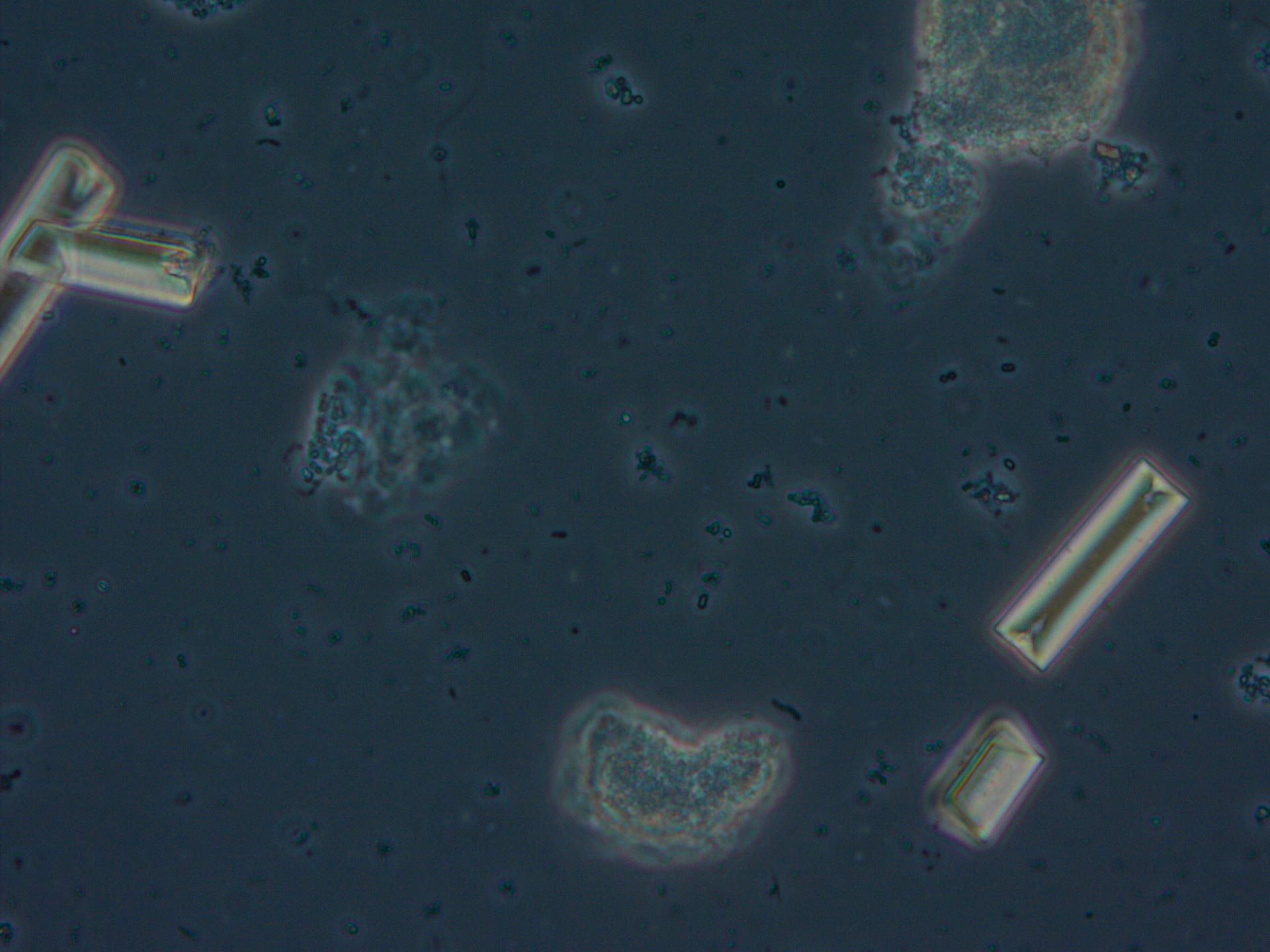 Phase contrast image of urine sediment
