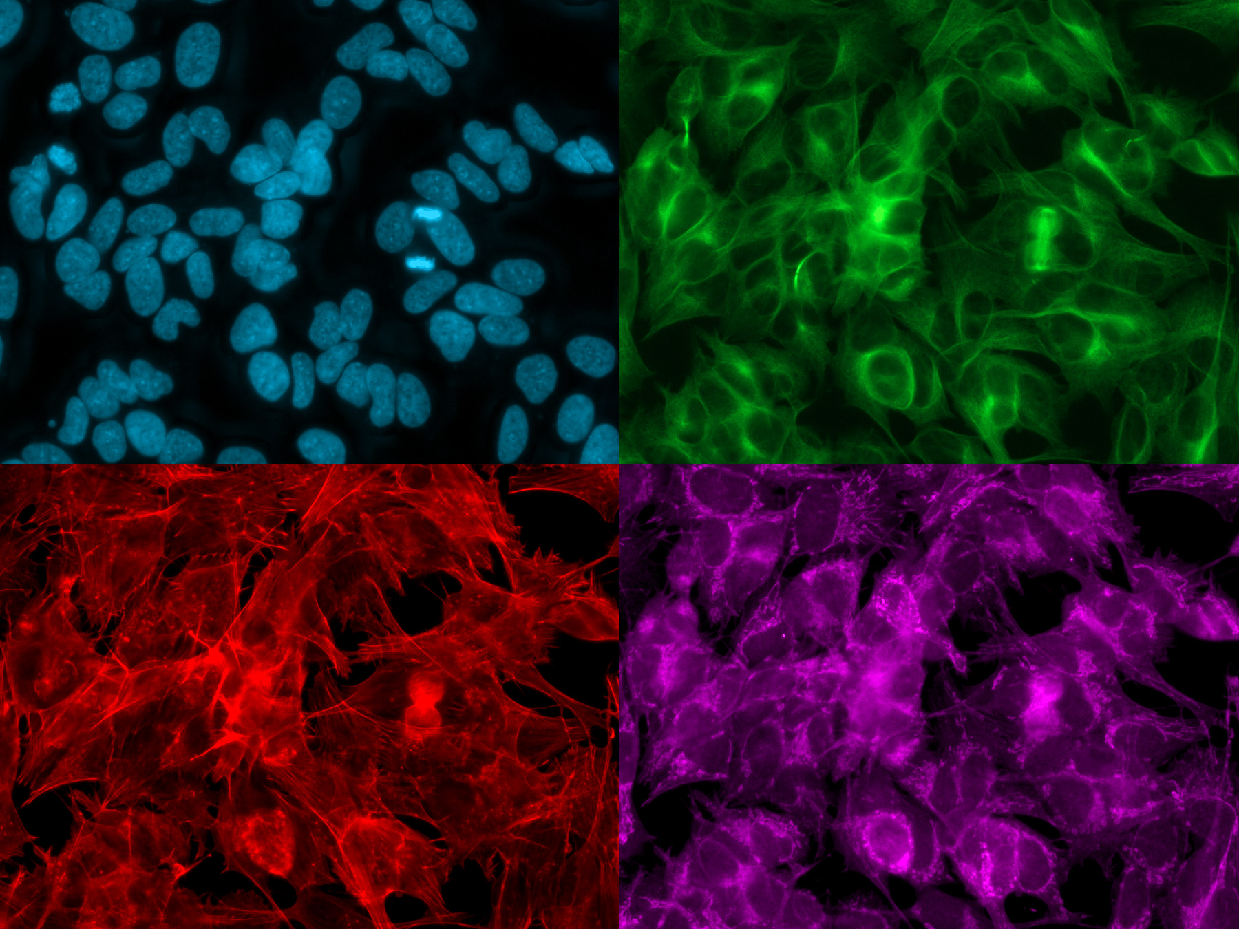 Cellules SH-SY5Y cultivées sur une plaque de microtitration de 384 cupules ; image multicanal en une seule position