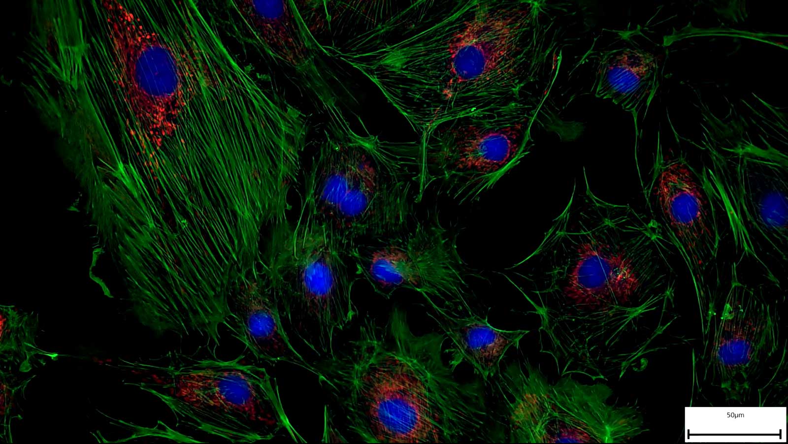 How to acquire a multichannel fluorescence image