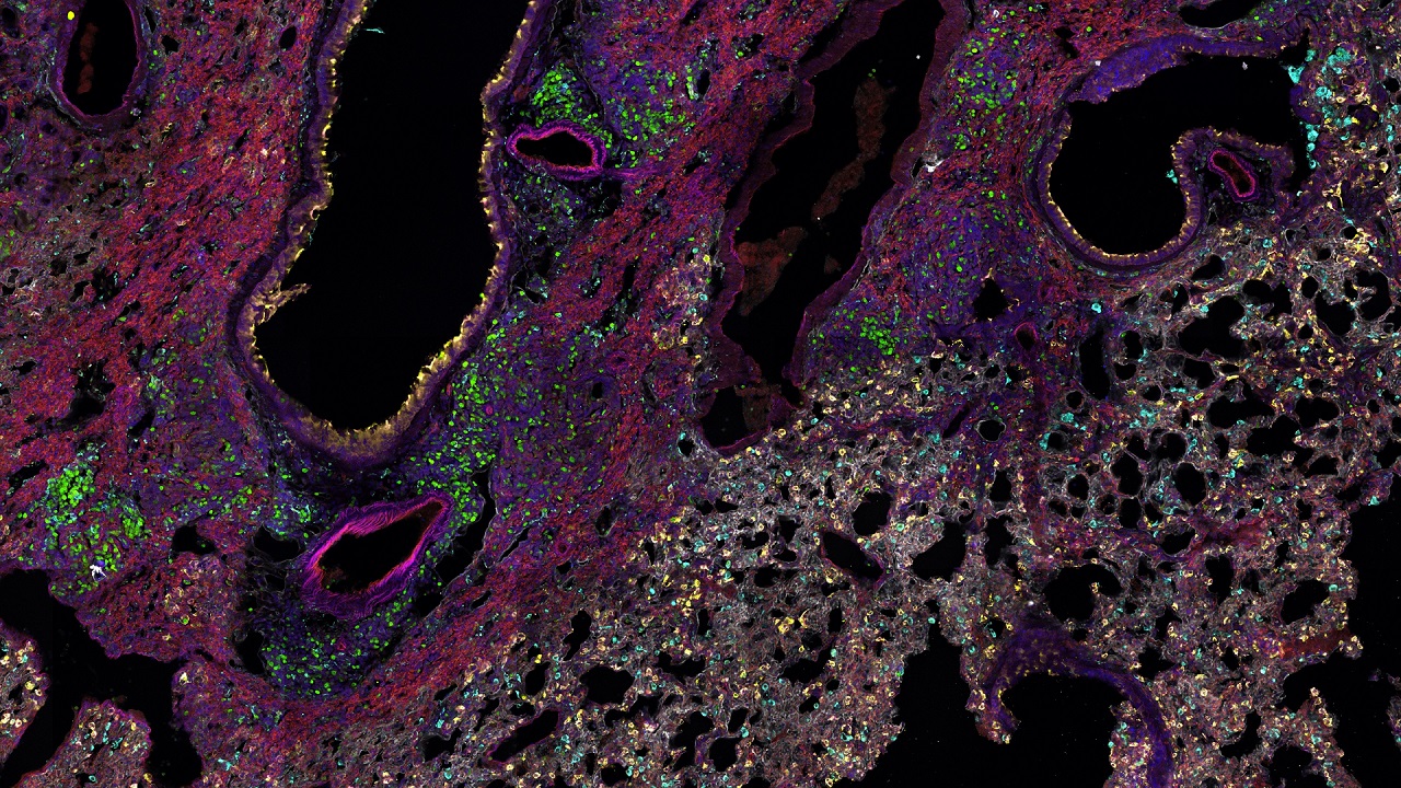 Spatial Biology Studies in Lung Tissue using Spectral Microscopy